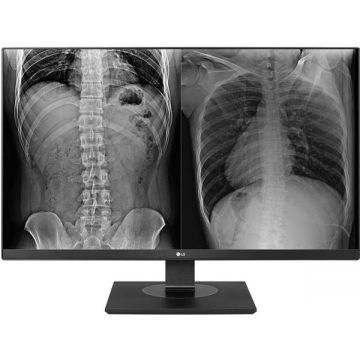 LG Monitor medical profesional IPS LED LG 27 27HJ713C-B, UHD (3840 x 2160), HDMI, DisplayPort, Pivot, Negru